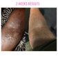 GET 40% OFF ! USE COUPON CODE  "my20today" at checkout.  Valid for this product only!Good Bye Eczema/Psoriasis-