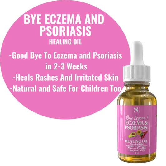 GET 40% OFF ! USE COUPON CODE  "my20today" at checkout.  Valid for this product only!Good Bye Eczema/Psoriasis-