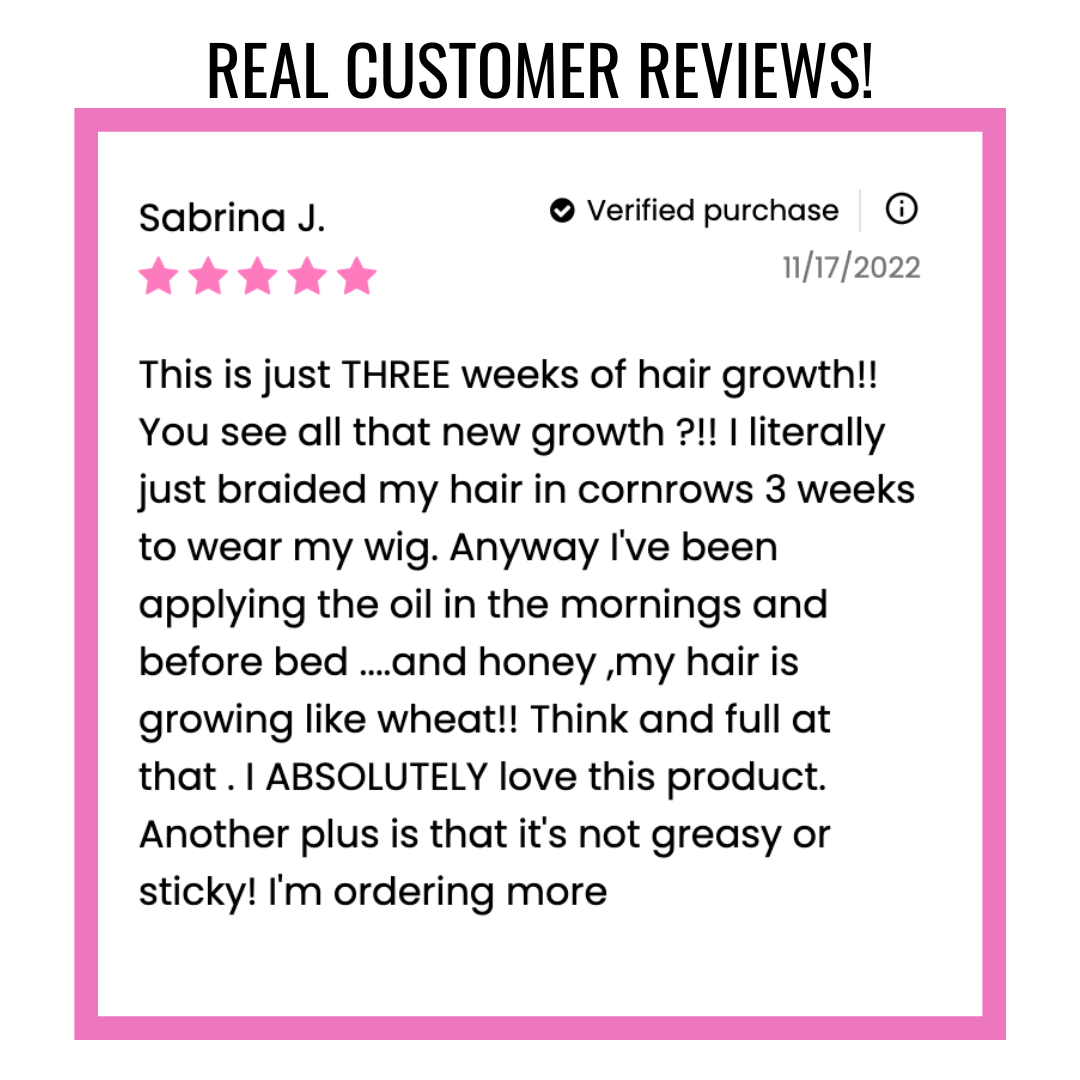 🔥35% OFF! JUMBO Size-Scalp Stimulator-Hair Growth Oil Extra Strength 2Month Supply- FREE SHIPPING )