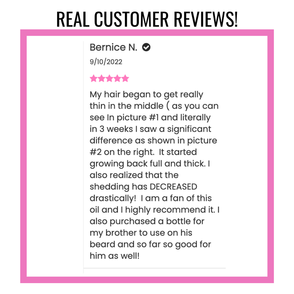 🔥JUMBO Size-Scalp Stimulator-Hair Growth Oil Extra Strength 4Month Supply- (BUY1GET1 FREE)